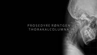 Link til Prosedyre røntgen thorakalcolumna